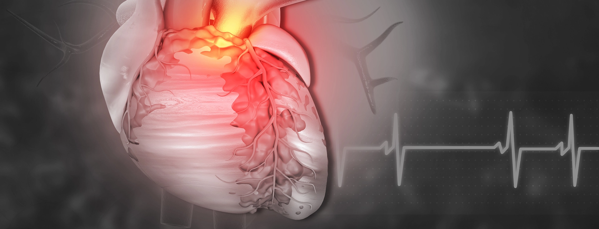 Salud Cardiovascular Integral