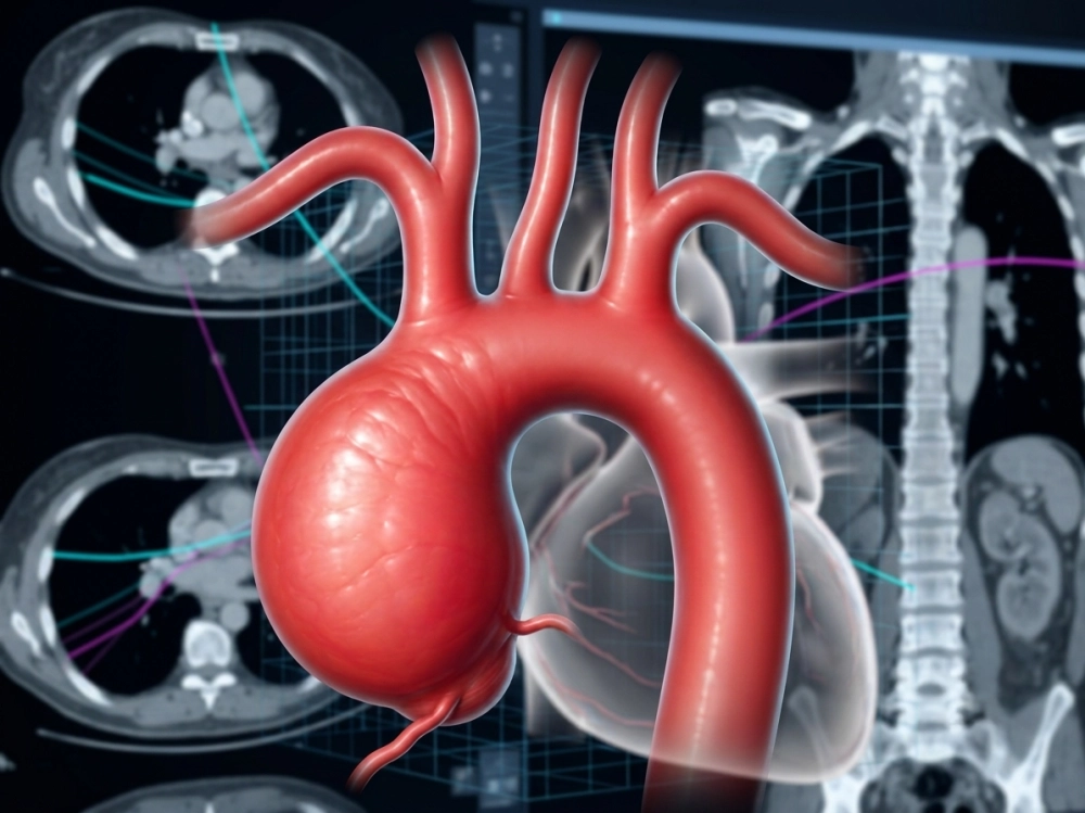 Aortopatías