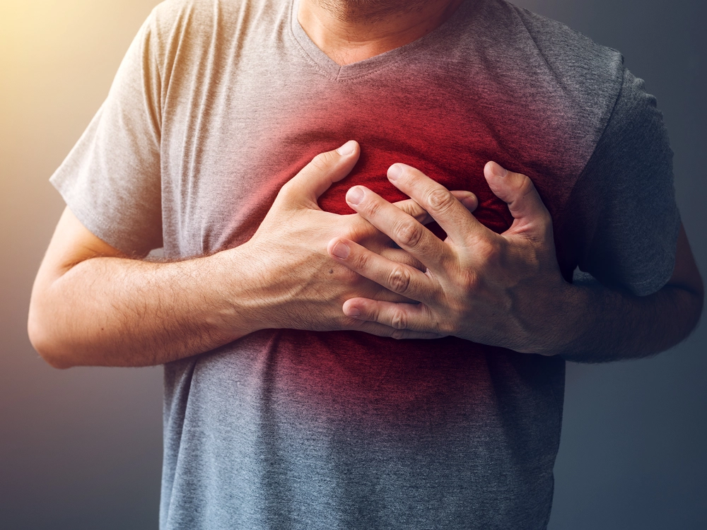 Cardiopatía Isquémica