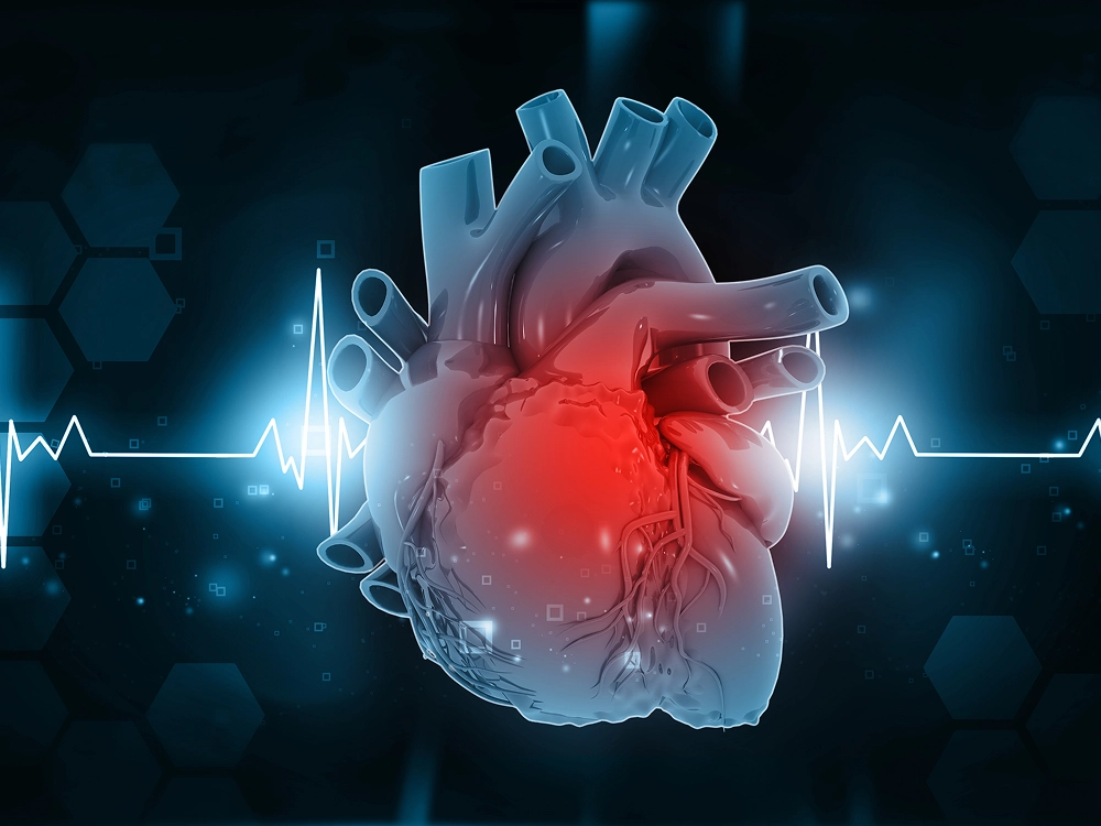 Miocardiopatías